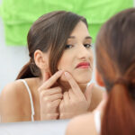 Best Acne Treatments for Teenage Boys